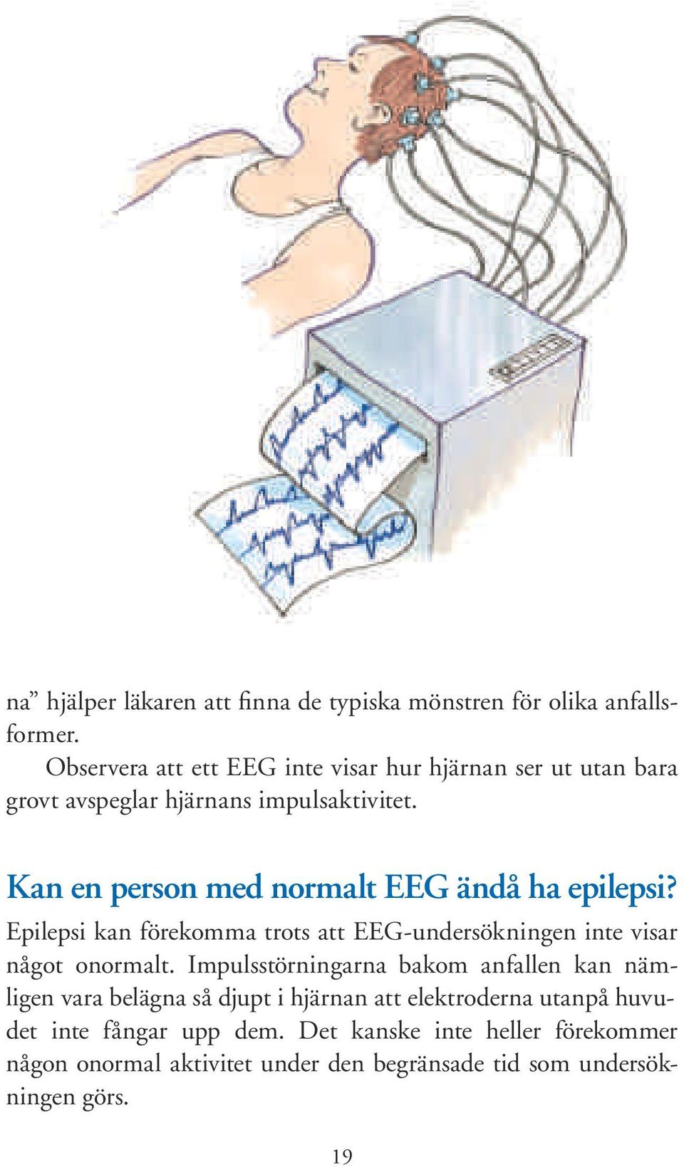 Kan en person med normalt EEG ändå ha epilepsi? Epilepsi kan förekomma trots att EEG-undersökningen inte visar något onormalt.