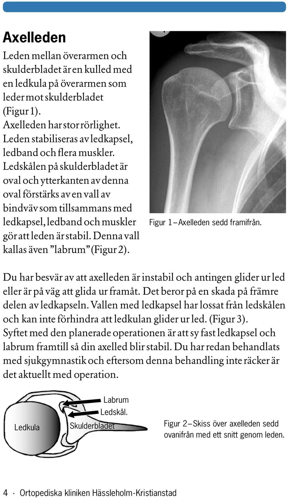 Ledskålen på skul derbladet är oval och ytterkanten av denna oval förstärks av en vall av bindväv som tillsammans med ledkapsel, ledband och muskler gör att leden är stabil.