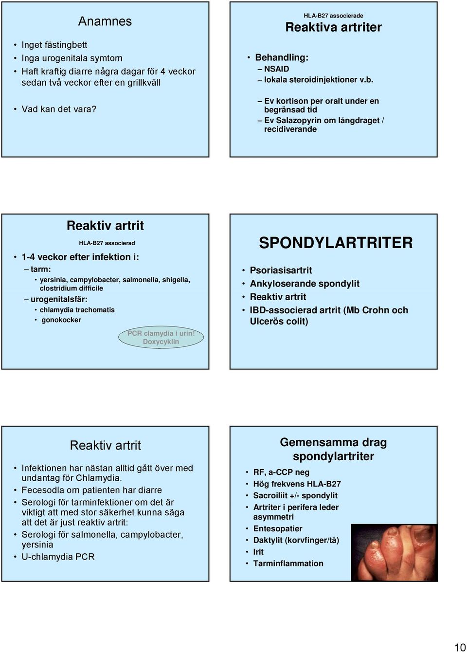 Ev kortison per oralt under en begränsad tid Ev Salazopyrin om långdraget / recidiverande Reaktiv artrit HLA-B27 associerad 1-4 veckor efter infektion i: tarm: yersinia, campylobacter, salmonella,