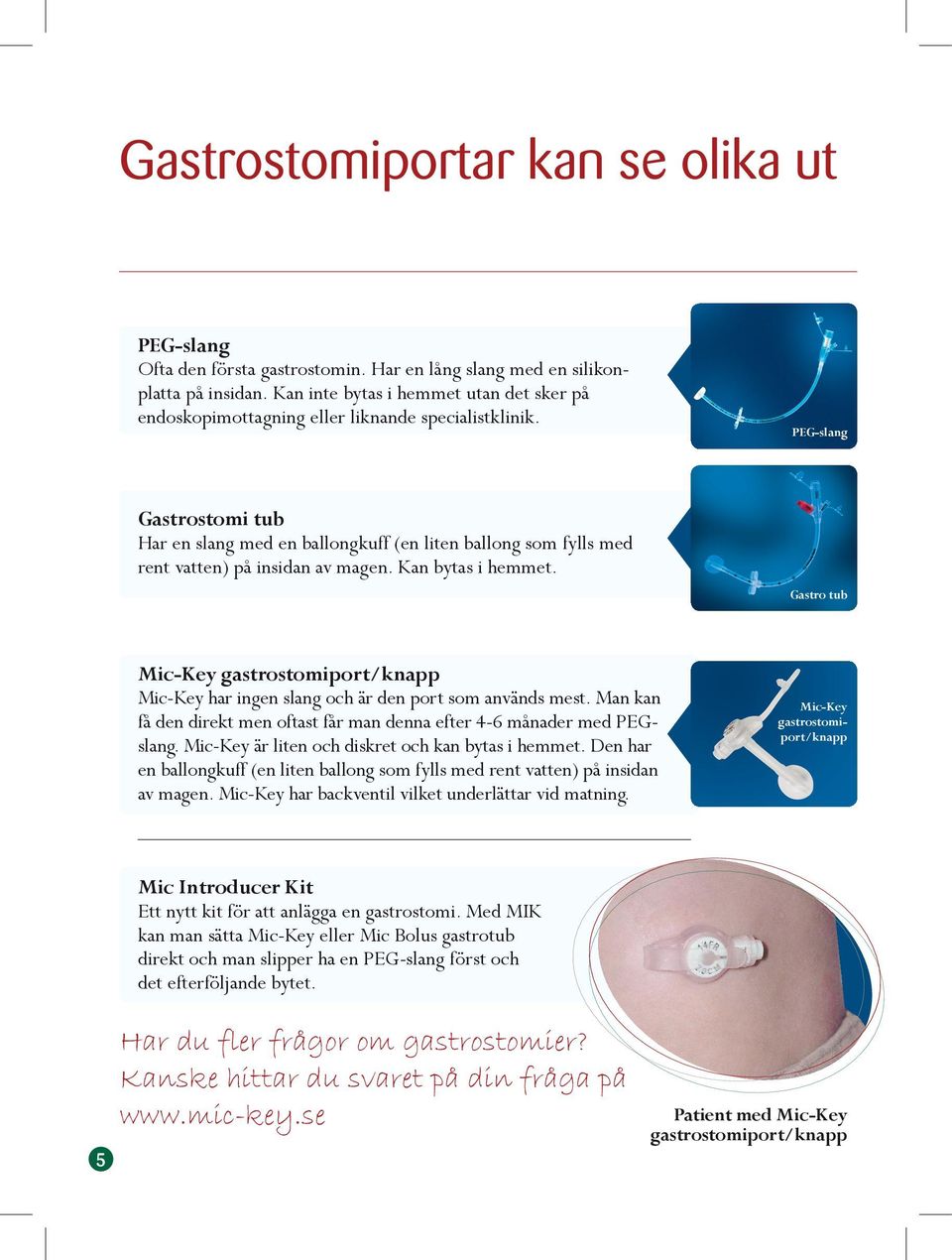 PEG-slang Gastrostomi tub Har en slang med en ballongkuff (en liten ballong som fylls med rent vatten) på insidan av magen. Kan bytas i hemmet.