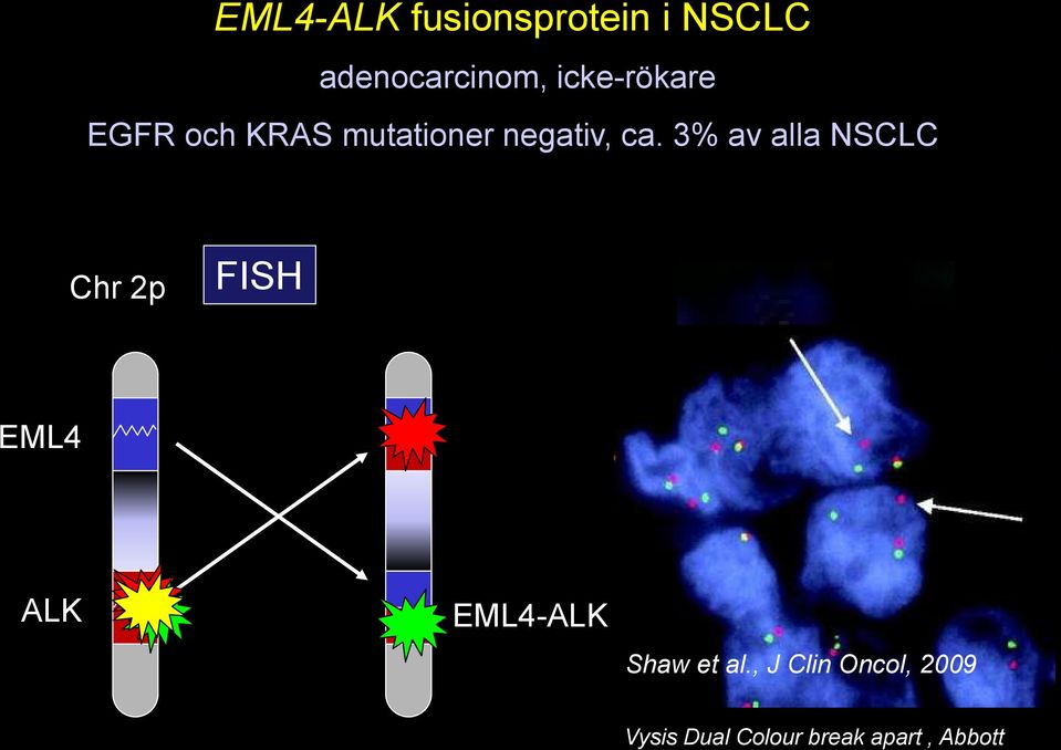 3% av alla NSCLC Chr 2p FISH EML4 ALK EML4-ALK Shaw