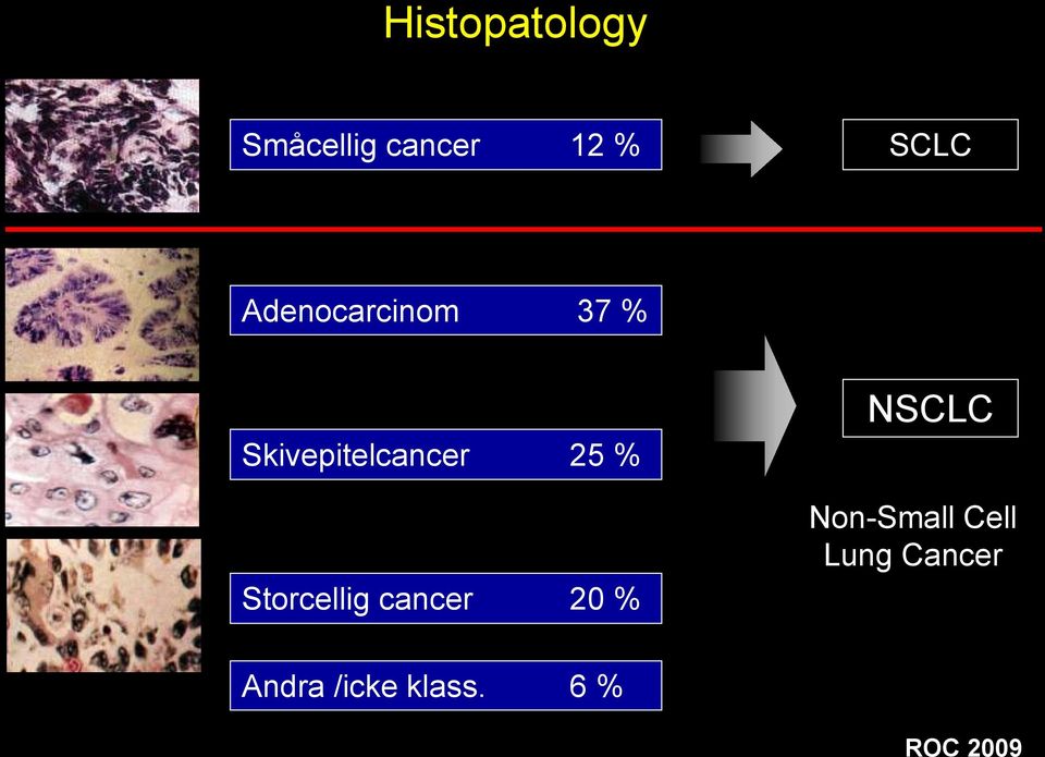 Storcellig cancer 20 % NSCLC Non-Small