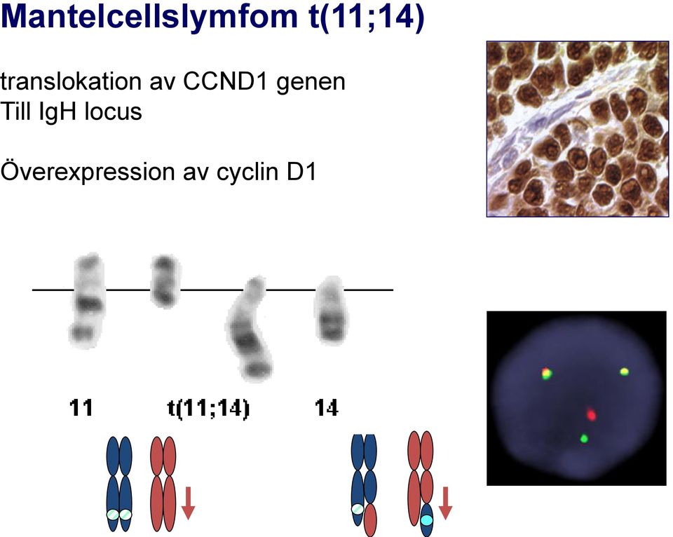 av CCND1 genen Till IgH