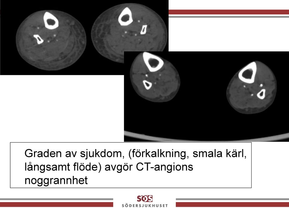 kärl, långsamt flöde)