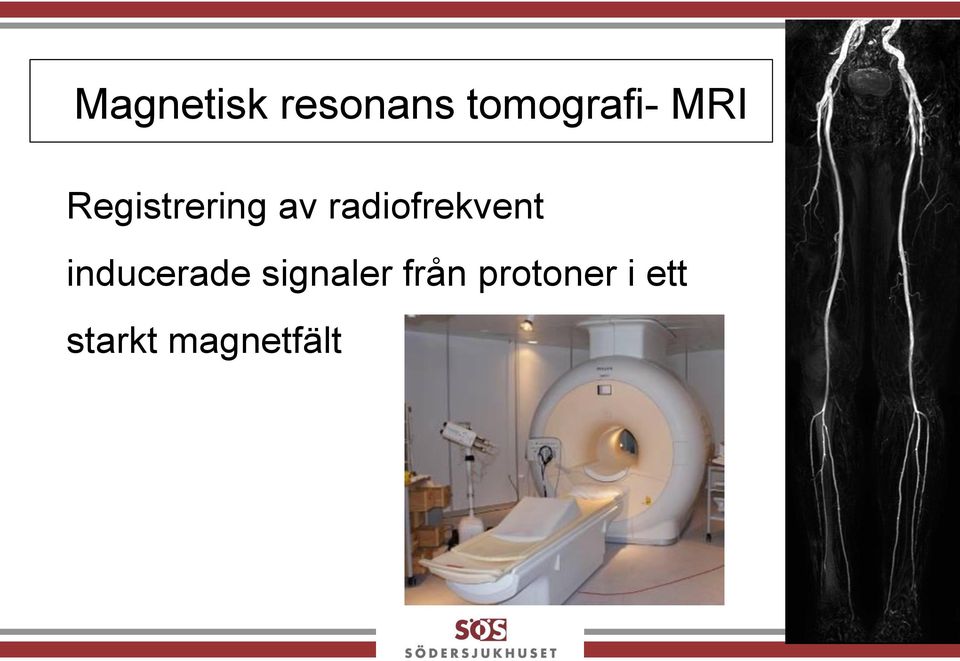 radiofrekvent inducerade