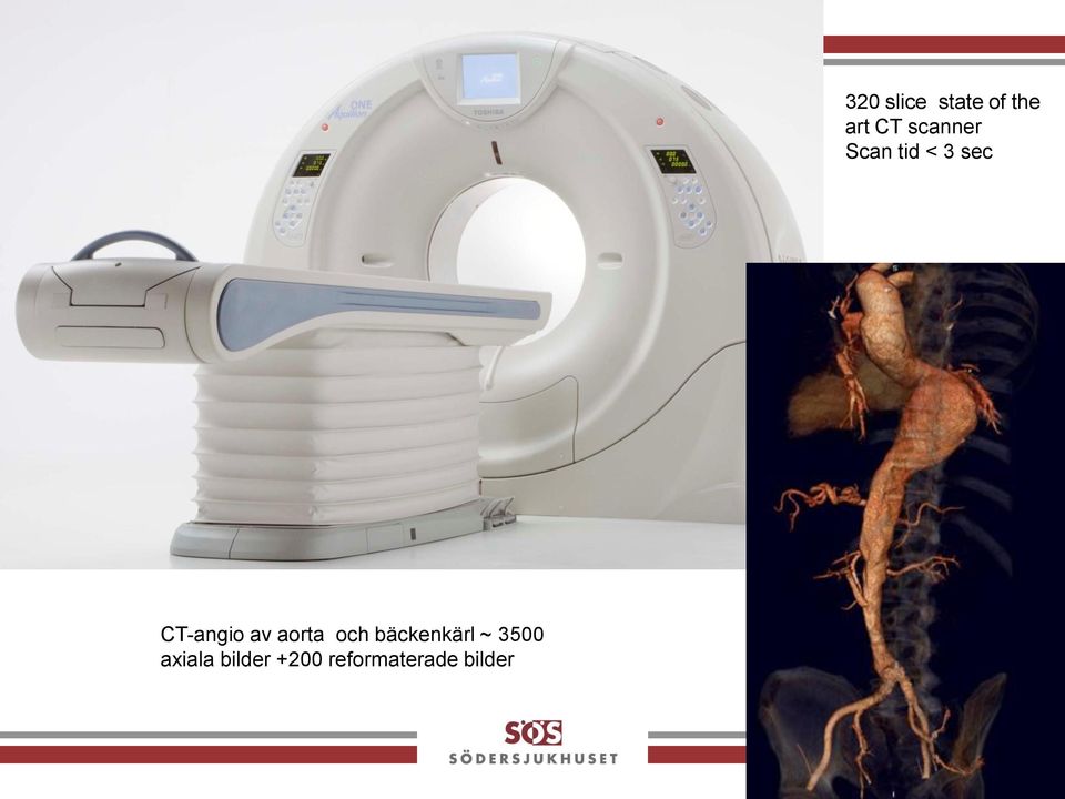 reformaterade bilder 320 slice
