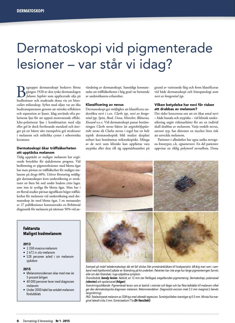 Svenska Sällskapet för Dermatologi och Venereologi Nummer - PDF ...