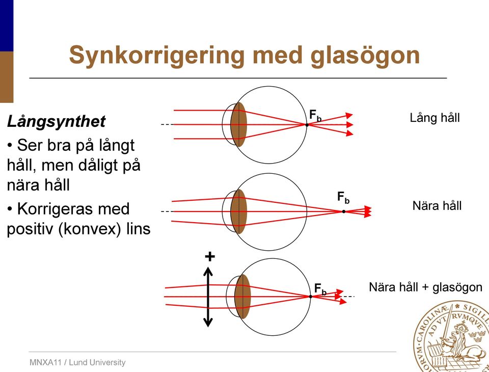 Korrigeras med positiv (konvex) lins + F b F