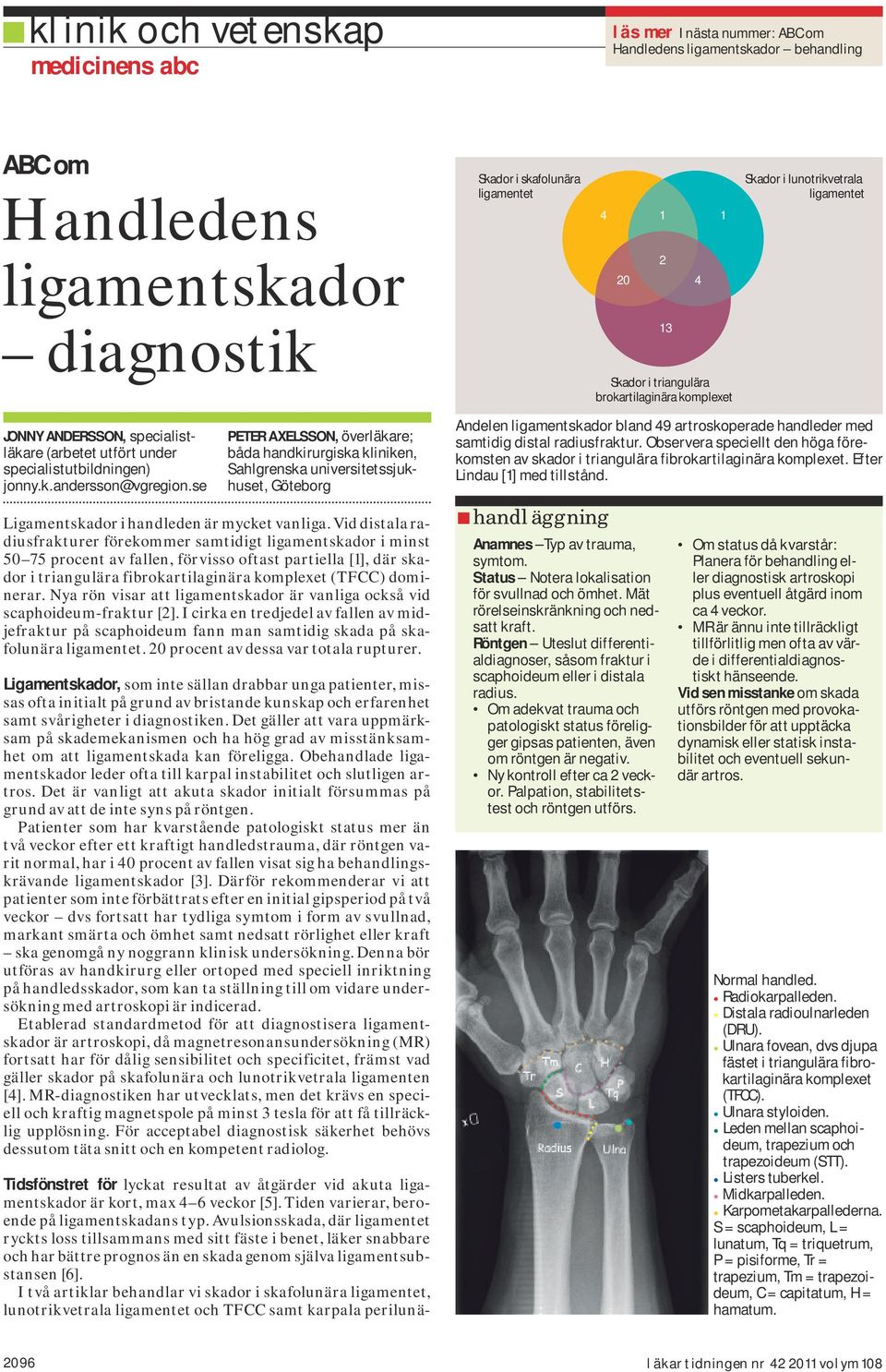 se PETER AXELSSON, överläkare; båda handkirurgiska kliniken, Sahlgrenska universitetssjukhuset, Göteborg Ligamentskador i handleden är mycket vanliga.