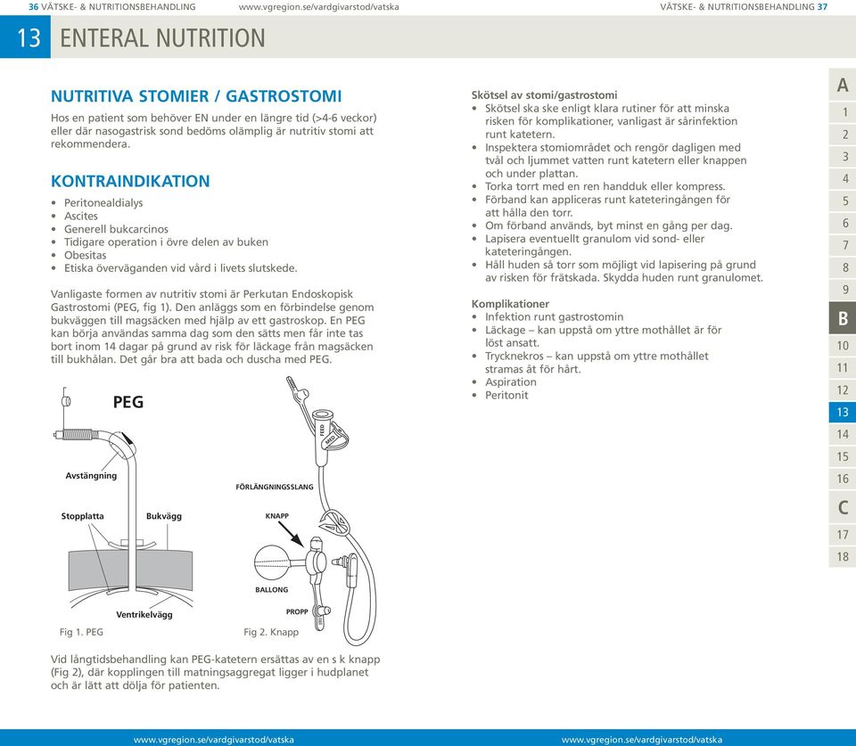 KONTRINDIKTION Peritonealdialys scites Generell bukcarcinos Tidigare operation i övre delen av buken Obesitas Etiska överväganden vid vård i livets slutskede.