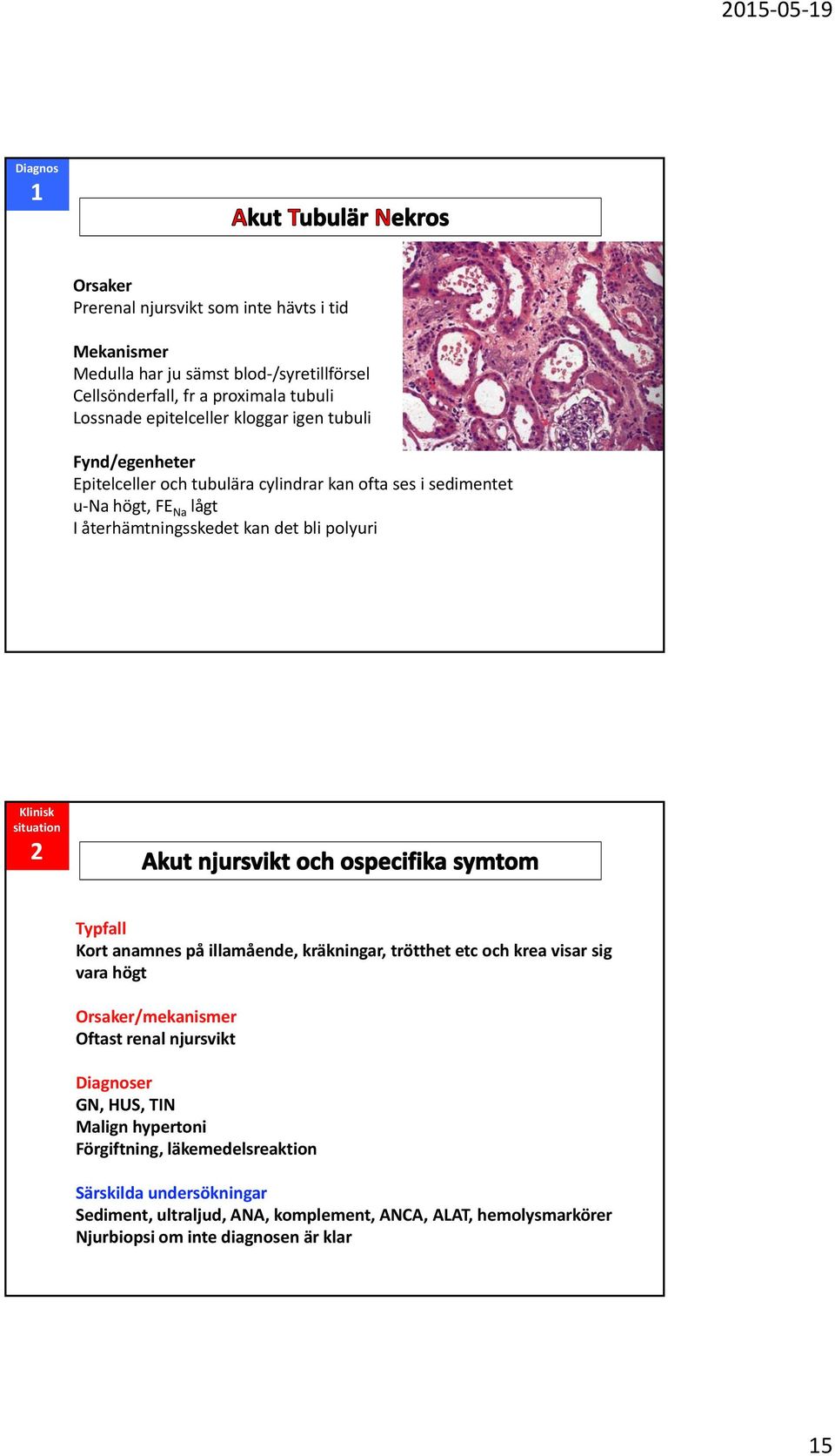 situation 2 Typfall Kort anamnes på illamående, kräkningar, trötthet etc och krea visar sig vara högt Orsaker/mekanismer Oftast renal njursvikt Diagnoser GN, HUS, TIN