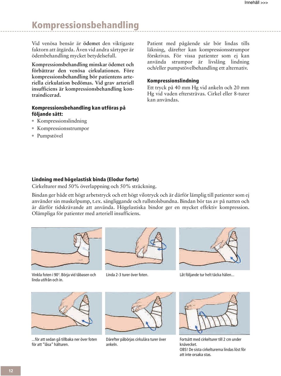 Vid grav arteriell insufficiens är kompressionsbehandling kontraindicerad.