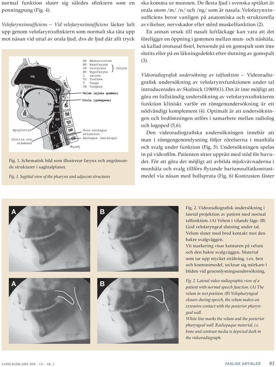 Uvula (gomspene) Fig. 1. Schematisk bild som illustrerar farynx och angränsande strukturer i sagittalplanet. Fig. 1. Sagittal view of the pharynx and adjacent structures ska komma ur munnen.