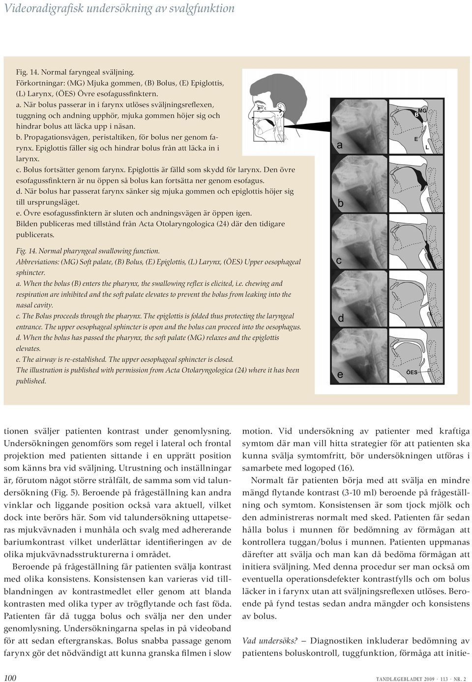 Epiglottis är fälld som skydd för larynx. Den övre esofagussfinktern är nu öppen så bolus kan fortsätta ner genom esofagus. d.