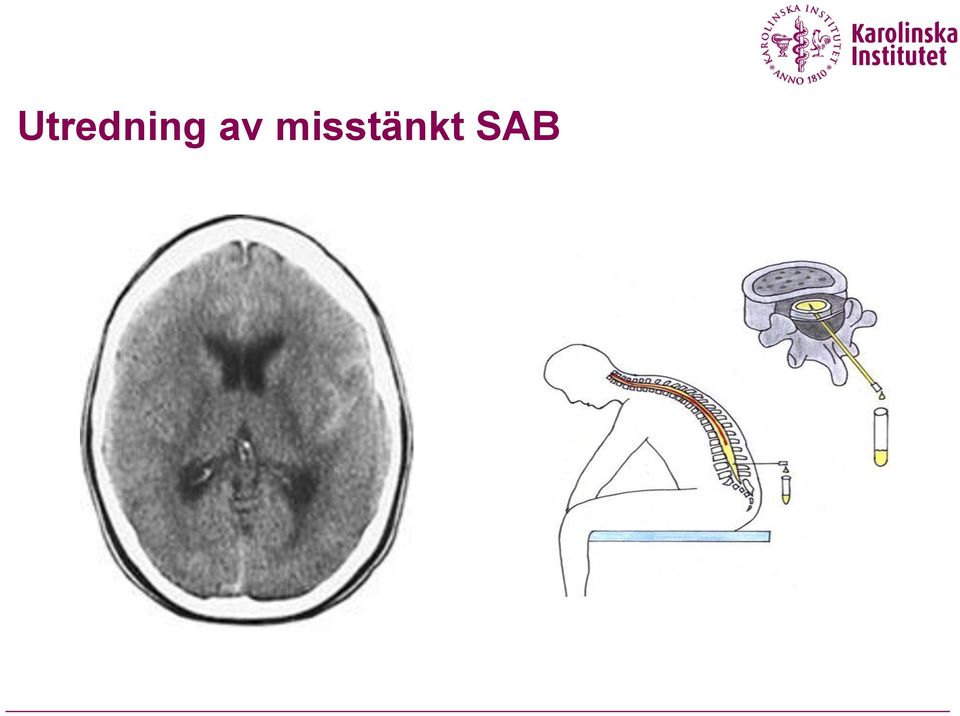 misstänkt