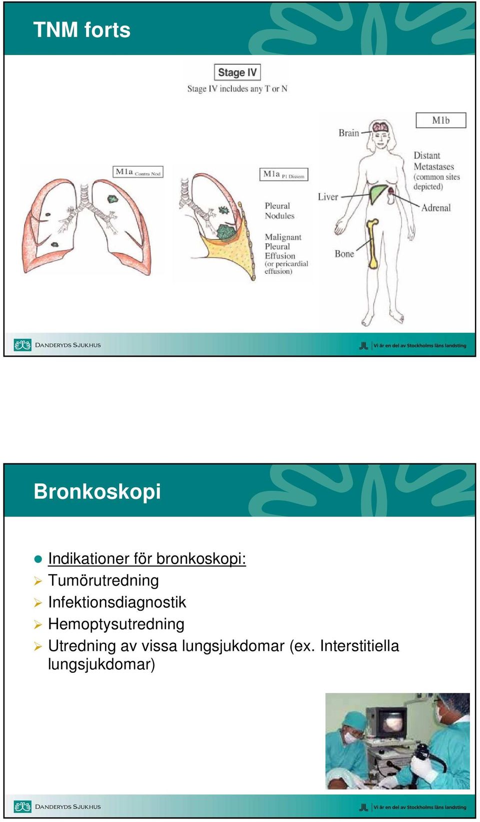 Infektionsdiagnostik Hemoptysutredning