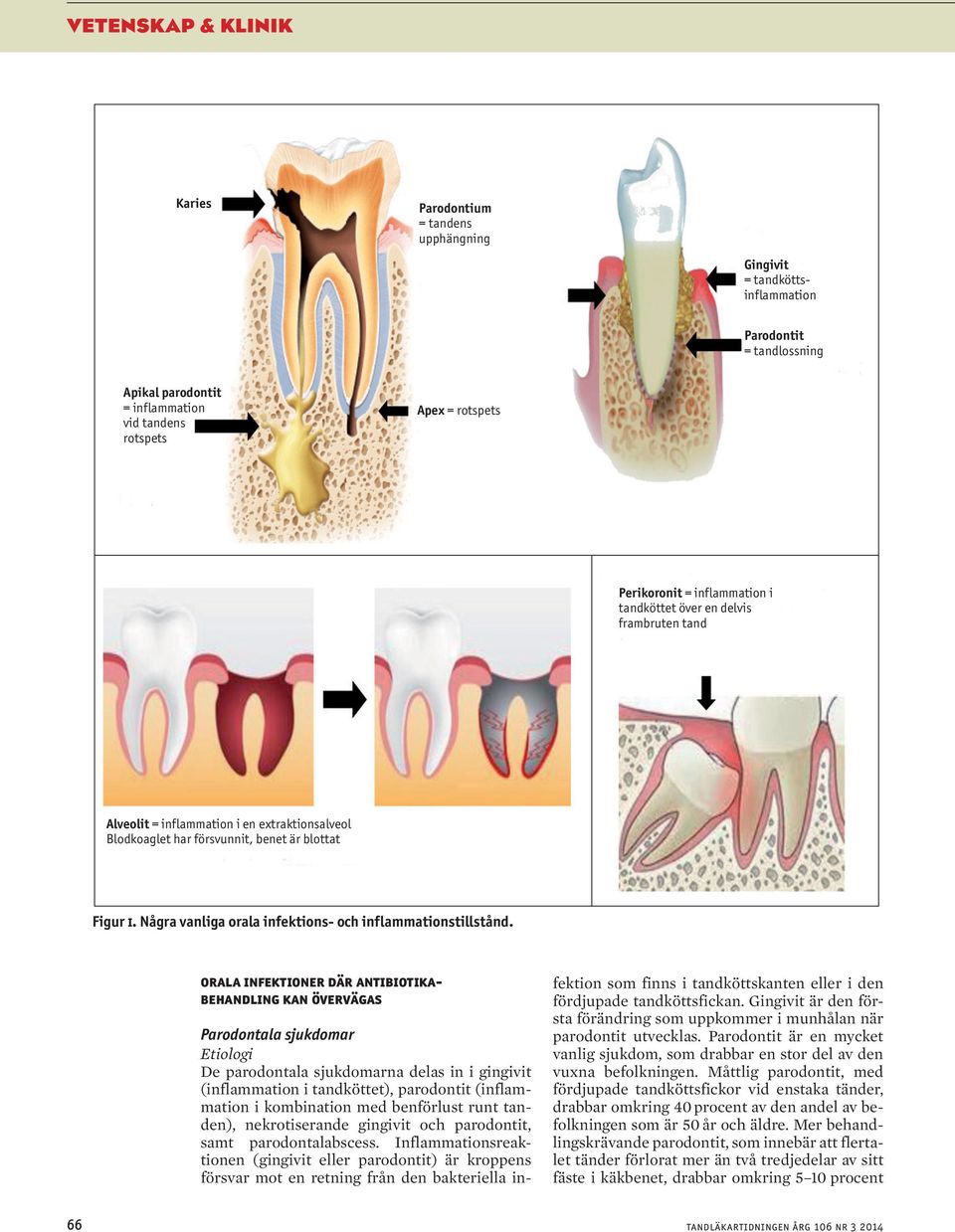 Några vanliga orala infektions- och inflammationstillstånd.