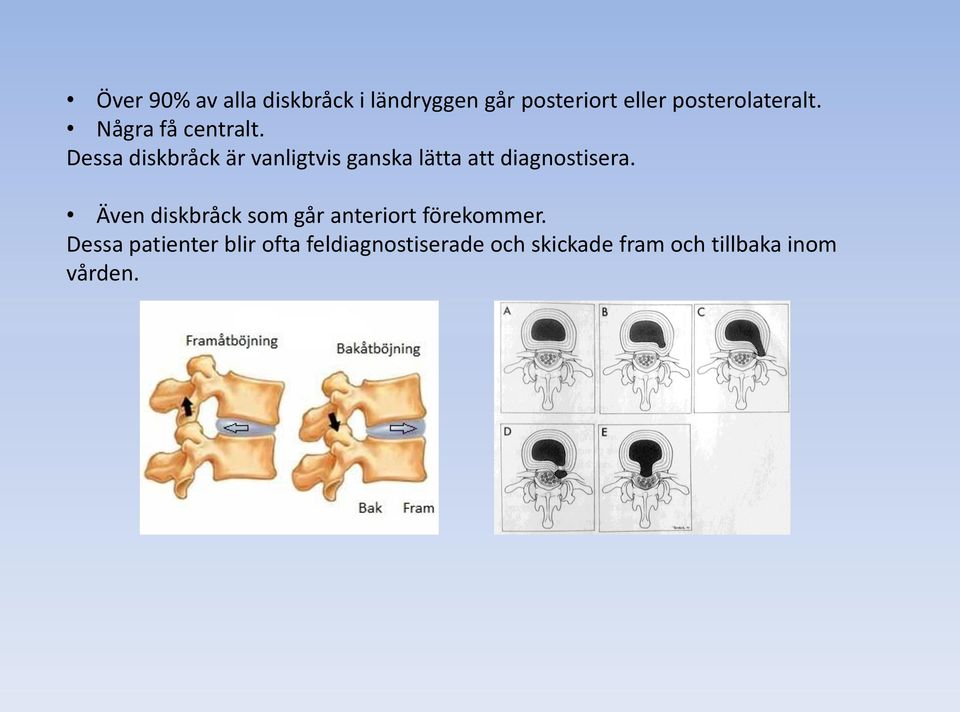 Dessa diskbråck är vanligtvis ganska lätta att diagnostisera.