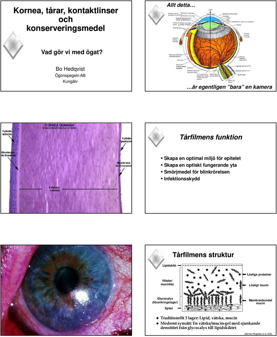 Tårfilmens struktur Lösliga proteiner Vätske/ mucinfas Lösligt mucin Glycocalyx (förankringslager) Epitel Membranbundet mucin Traditionellt 3