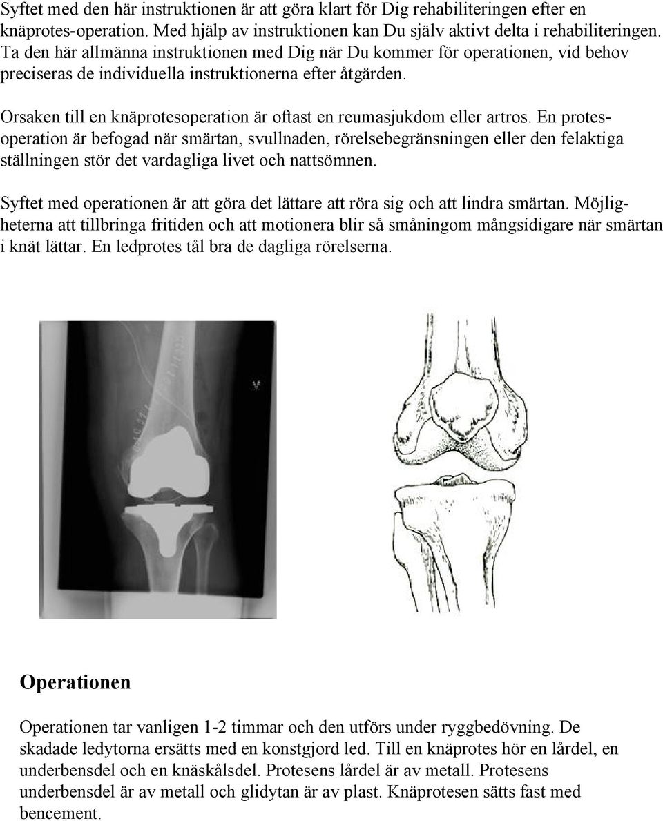 Orsaken till en knäprotesoperation är oftast en reumasjukdom eller artros.