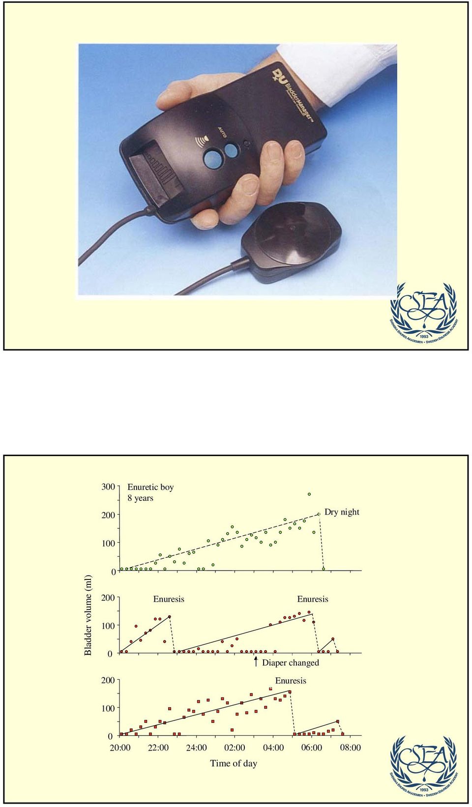 Enuresis Diaper changed 200 Enuresis 100 0