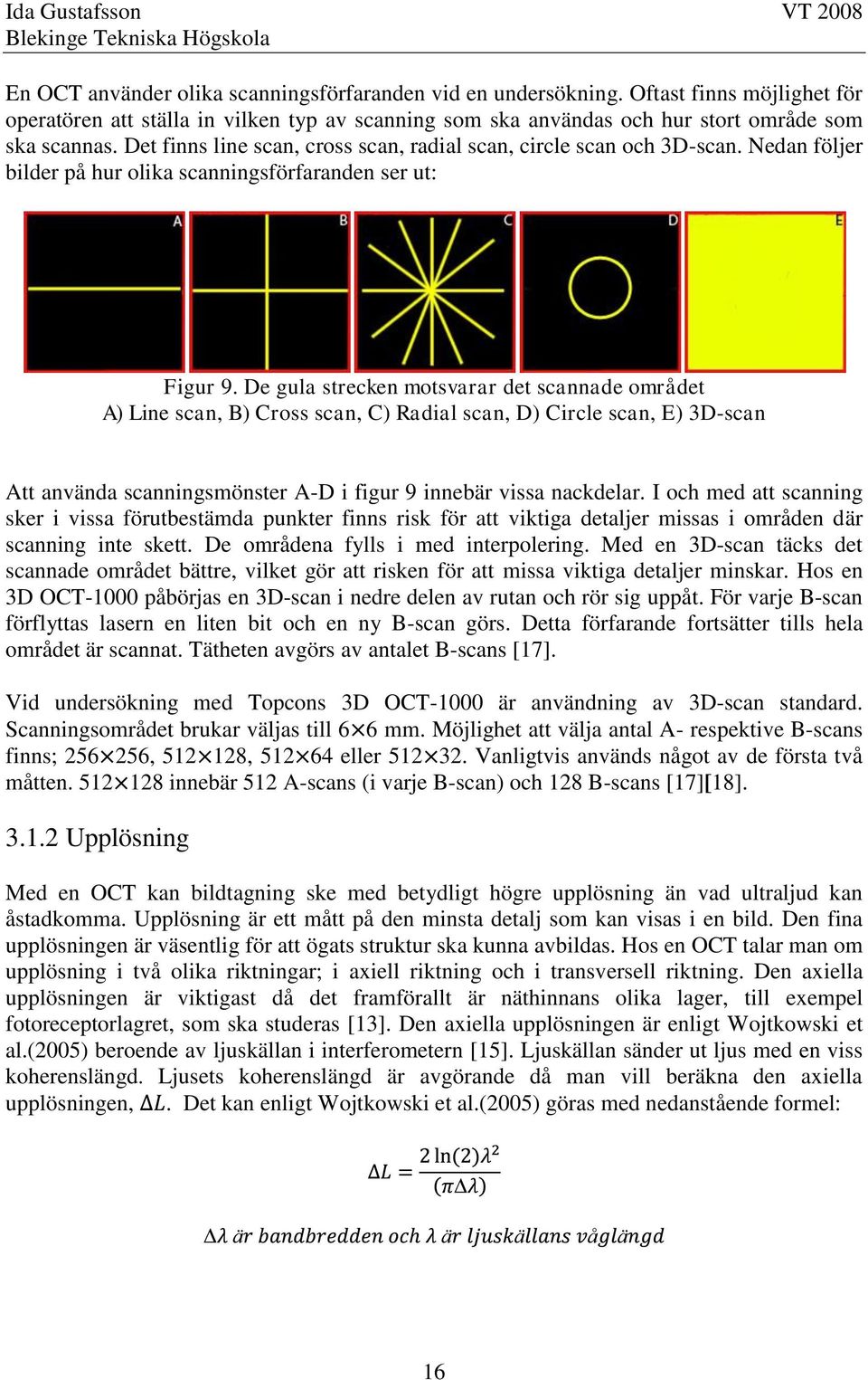 De gula strecken motsvarar det scannade området A) Line scan, B) Cross scan, C) Radial scan, D) Circle scan, E) 3D-scan Att använda scanningsmönster A-D i figur 9 innebär vissa nackdelar.