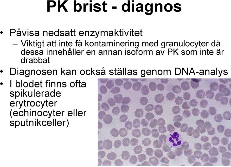 PK som inte är drabbat Diagnosen kan också ställas genom DNA-analys I