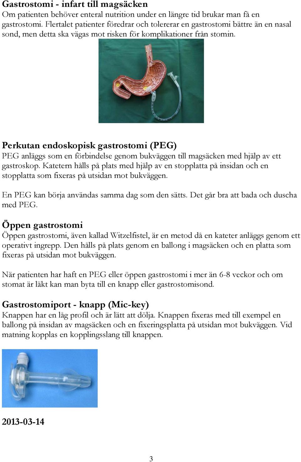 Perkutan endoskopisk gastrostomi (PEG) PEG anläggs som en förbindelse genom bukväggen till magsäcken med hjälp av ett gastroskop.