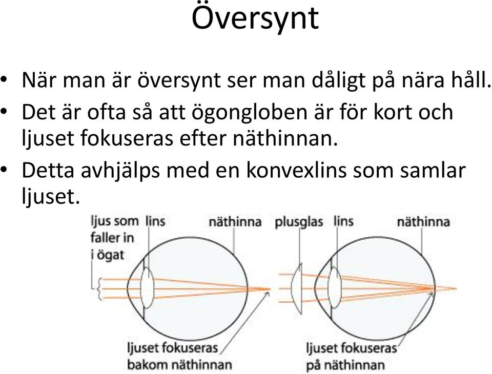 Det är ofta så att ögongloben är för kort och