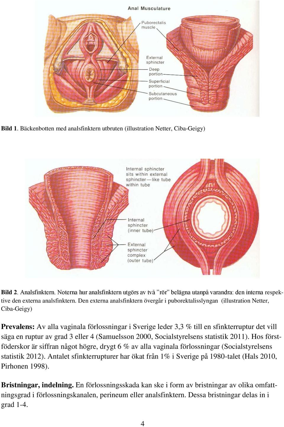 Den externa analsfinktern övergår i puborektalisslyngan (illustration Netter, Ciba-Geigy) Prevalens: Av alla vaginala förlossningar i Sverige leder 3,3 % till en sfinkterruptur det vill säga en
