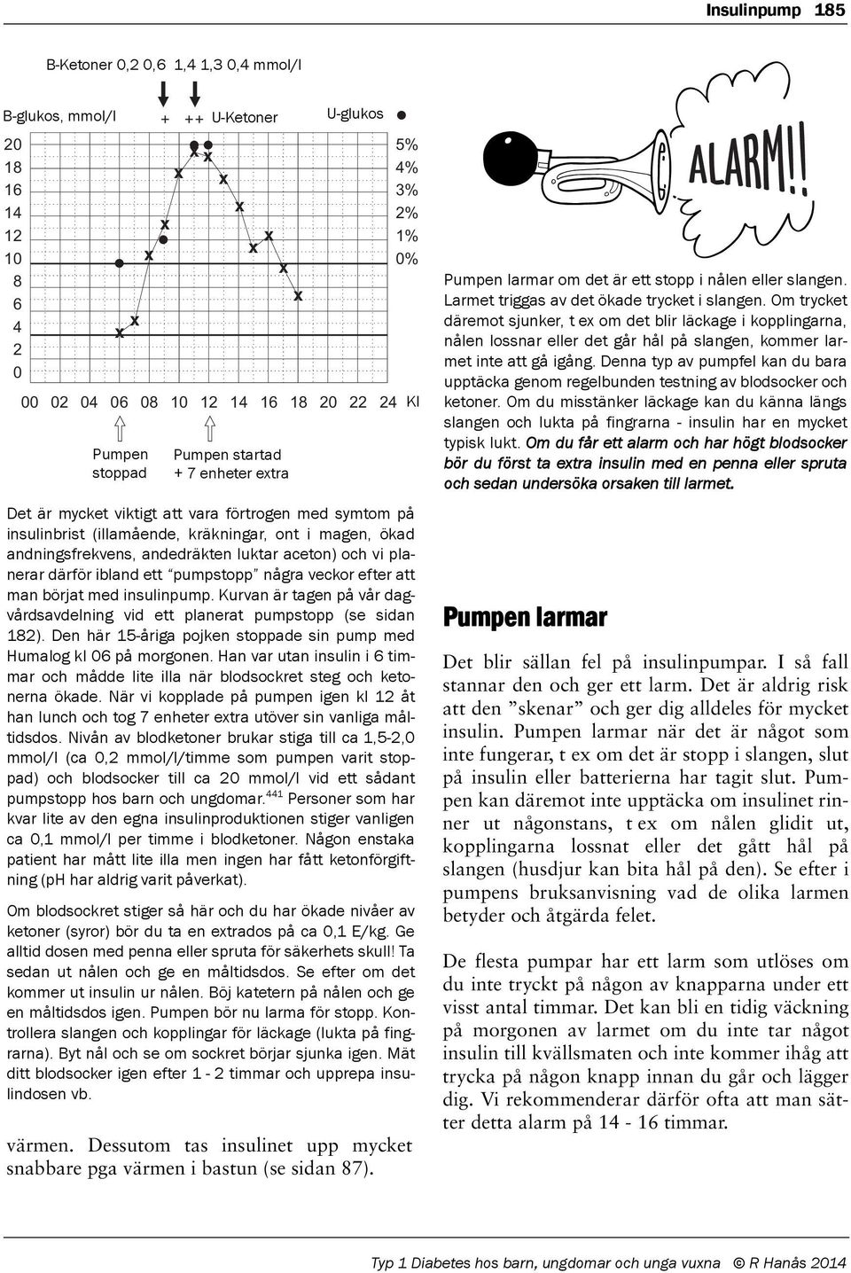 därför ibland ett pumpstopp några veckor efter att man börjat med insulinpump. Kurvan är tagen på vår dagvårdsavdelning vid ett planerat pumpstopp (se sidan 182).