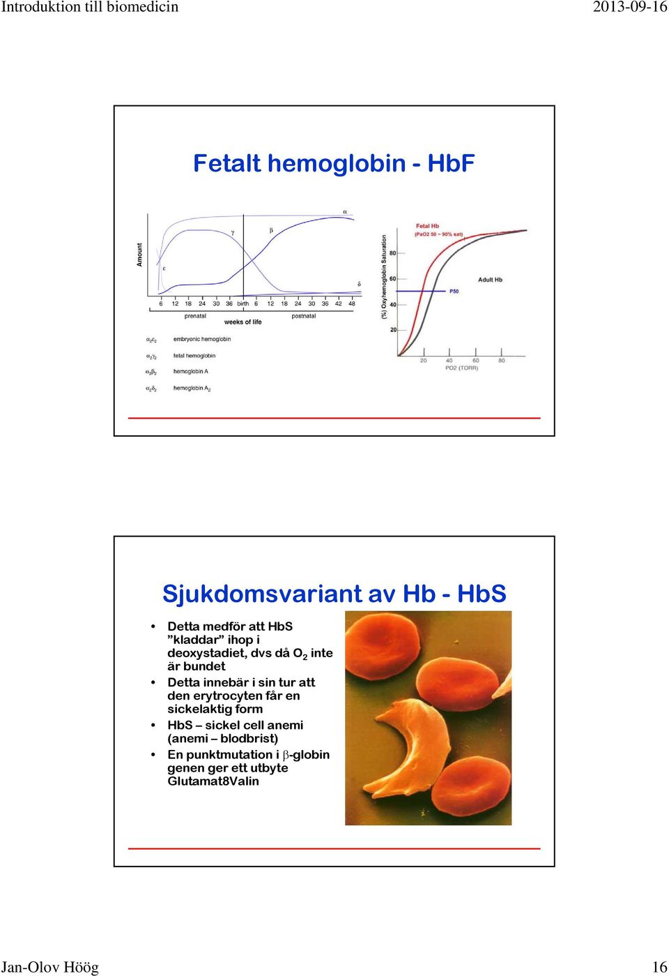 att den erytrocyten får en sickelaktig form HbS sickel cell anemi (anemi