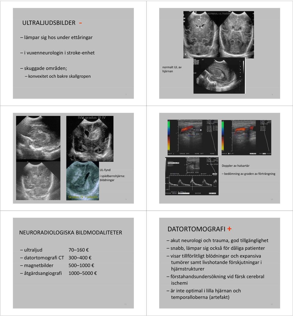 500 1000 åtgärdsangiografi 1000 5000 DATORTOMOGRAFI + akut neurologi och trauma, god tillgänglighet snabb, lämpar sig också för dåliga patienter visar tillförlitligt blödningar och