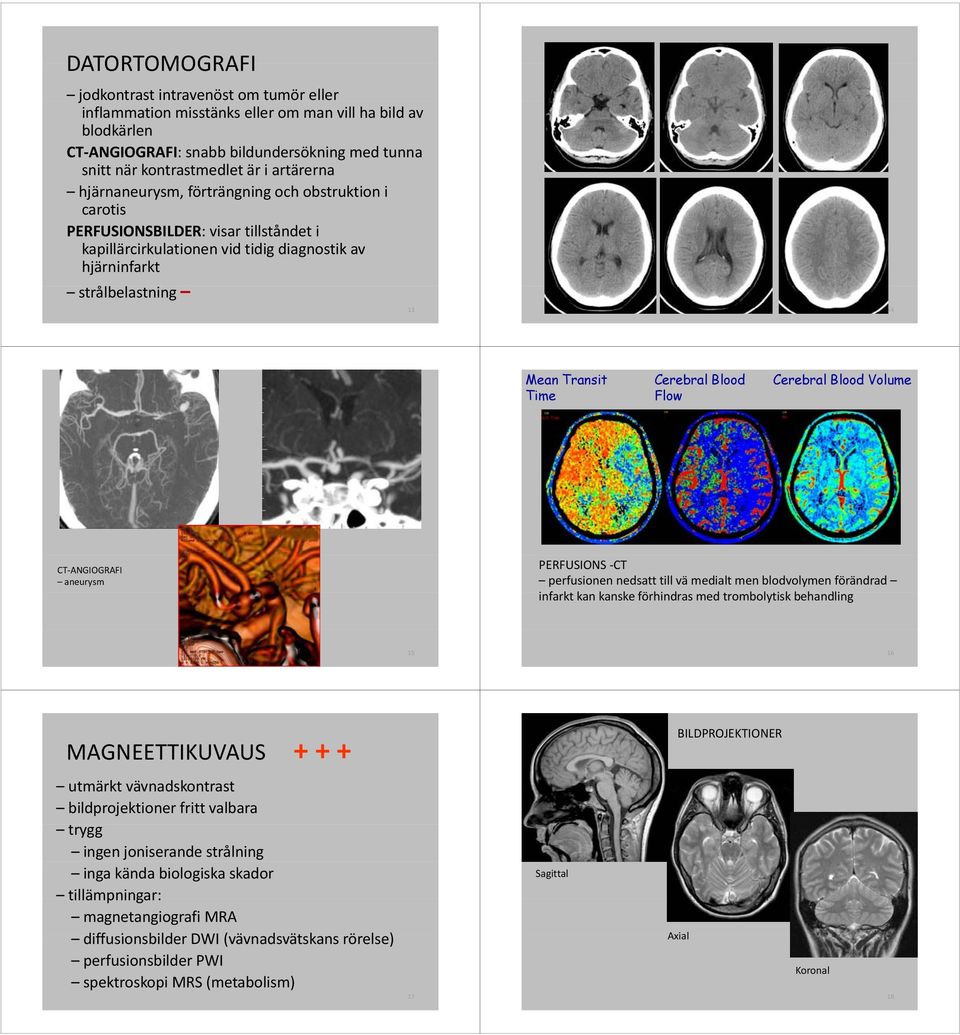 Time Cerebral Blood Flow Cerebral Blood Volume CT ANGIOGRAFI aneurysm PERFUSIONS CT perfusionen nedsatt till vä medialt men blodvolymen förändrad infarkt kan kanske k förhindras med trombolytisk