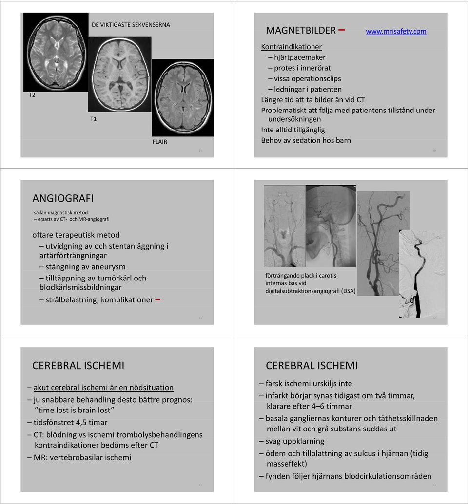 under undersökningen Inte alltid tillgänglig Behov av sedation hos barn 19 20 ANGIOGRAFI sällan diagnostisk metod ersatts av CT och MR angiografi oftareterapeutisk terapeutisk metod utvidgning av och