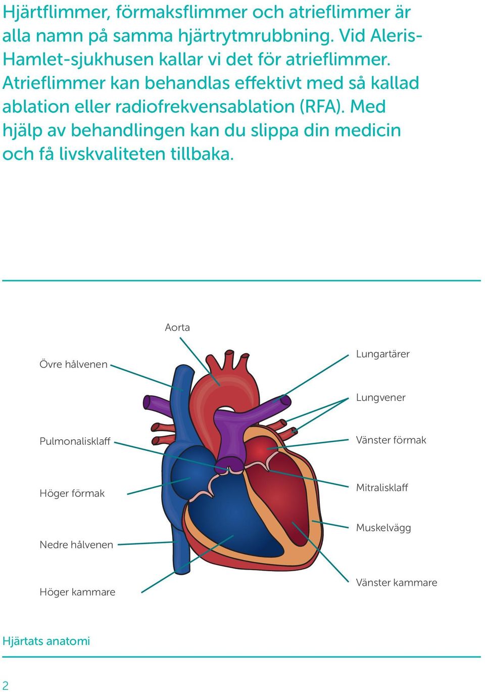 Atrieflimmer kan behandlas effektivt med så kallad ablation eller radiofrekvensablation (RFA).