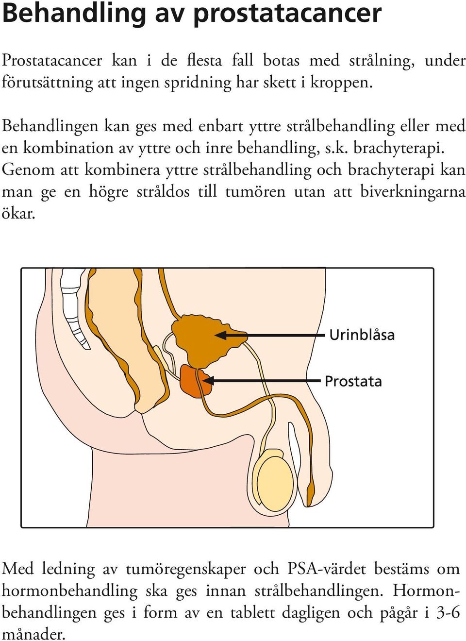 Genom att kombinera yttre strålbehandling och brachyterapi kan man ge en högre stråldos till tumören utan att biverkningarna ökar.