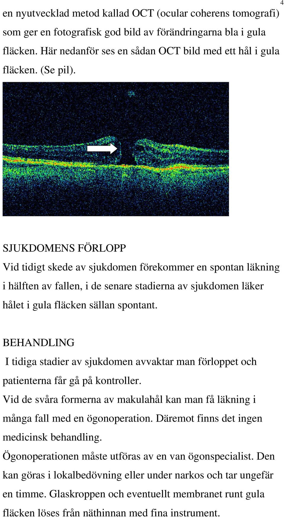 BEHANDLING I tidiga stadier av sjukdomen avvaktar man förloppet och patienterna får gå på kontroller. Vid de svåra formerna av makulahål kan man få läkning i många fall med en ögonoperation.