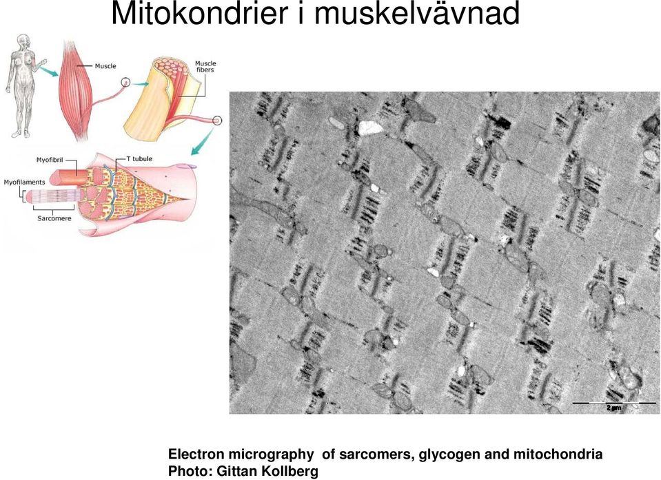 sarcomers, glycogen and