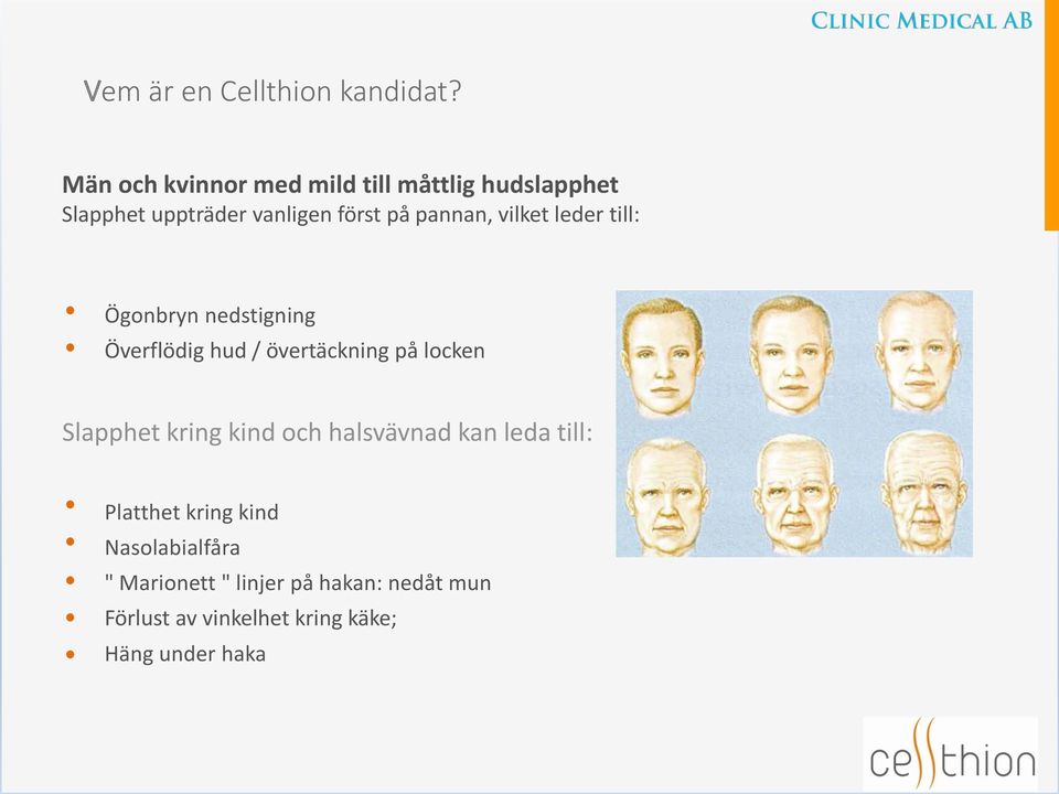 vilket leder till: Ögonbryn nedstigning Överflödig hud / övertäckning på locken Slapphet kring