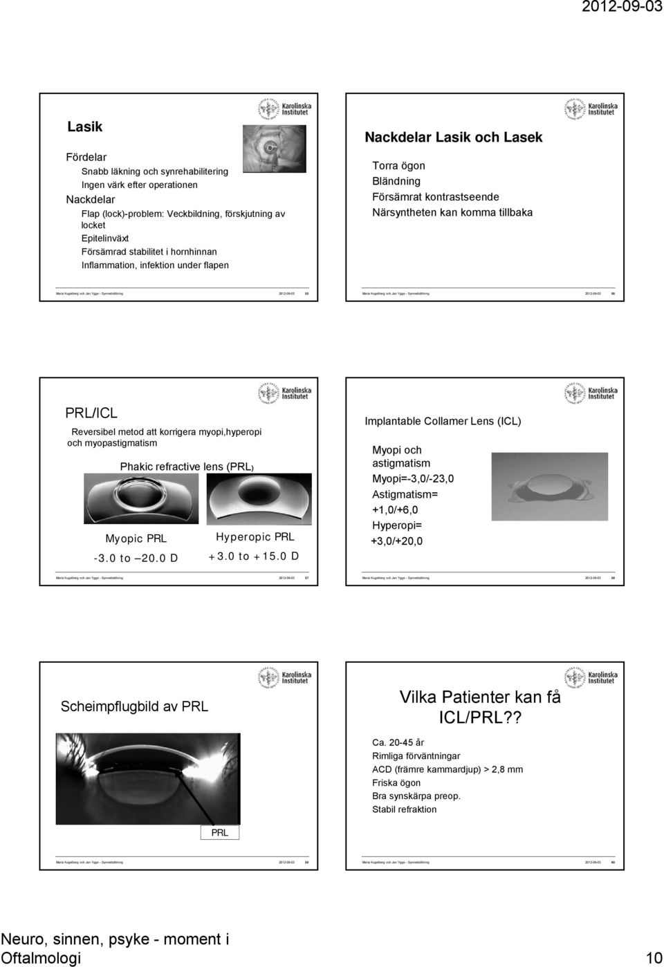 55 Maria Kugelberg och Jan Ygge - Synnedsättning 2012-09-03 56 PRL/ICL Reversibel metod att korrigera myopi,hyperopi och myopastigmatism Phakic refractive lens (PRL) Myopic PRL -3.0 to 20.