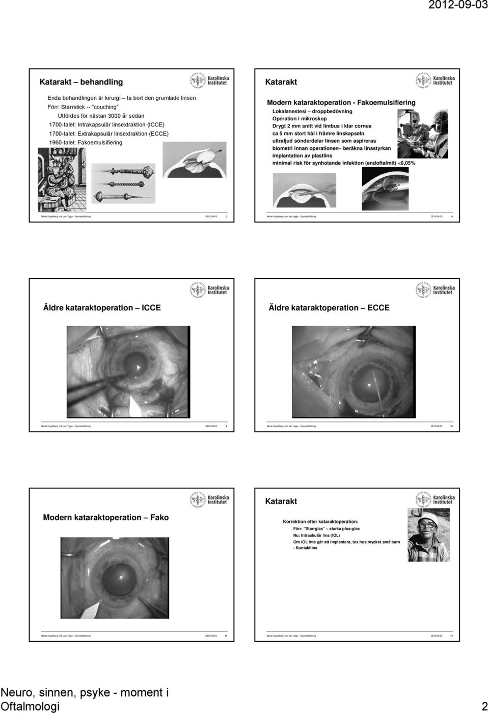 cornea ca 5 mm stort hål i främre linskapseln ultraljud sönderdelar linsen som aspireras biometri innan operationen beräkna linsstyrkan implantation av plastlins minimal risk för synhotande infektion