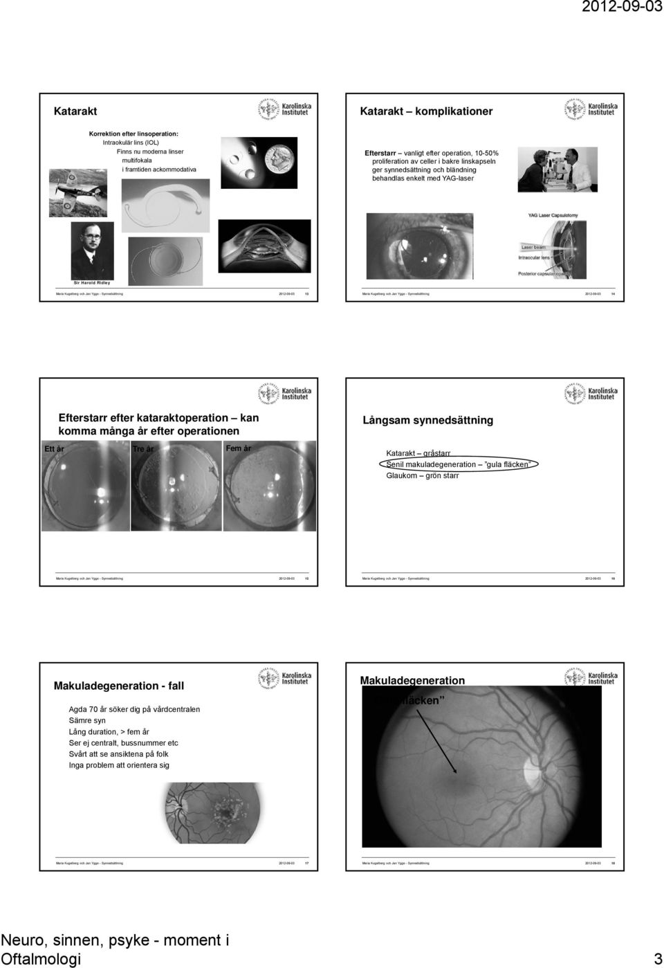 Synnedsättning 2012-09-03 14 Efterstarr efter kataraktoperation kan komma många år efter operationen Ett år Tre år Fem år Långsam synnedsättning gråstarr Senil makuladegeneration gula fläcken Glaukom