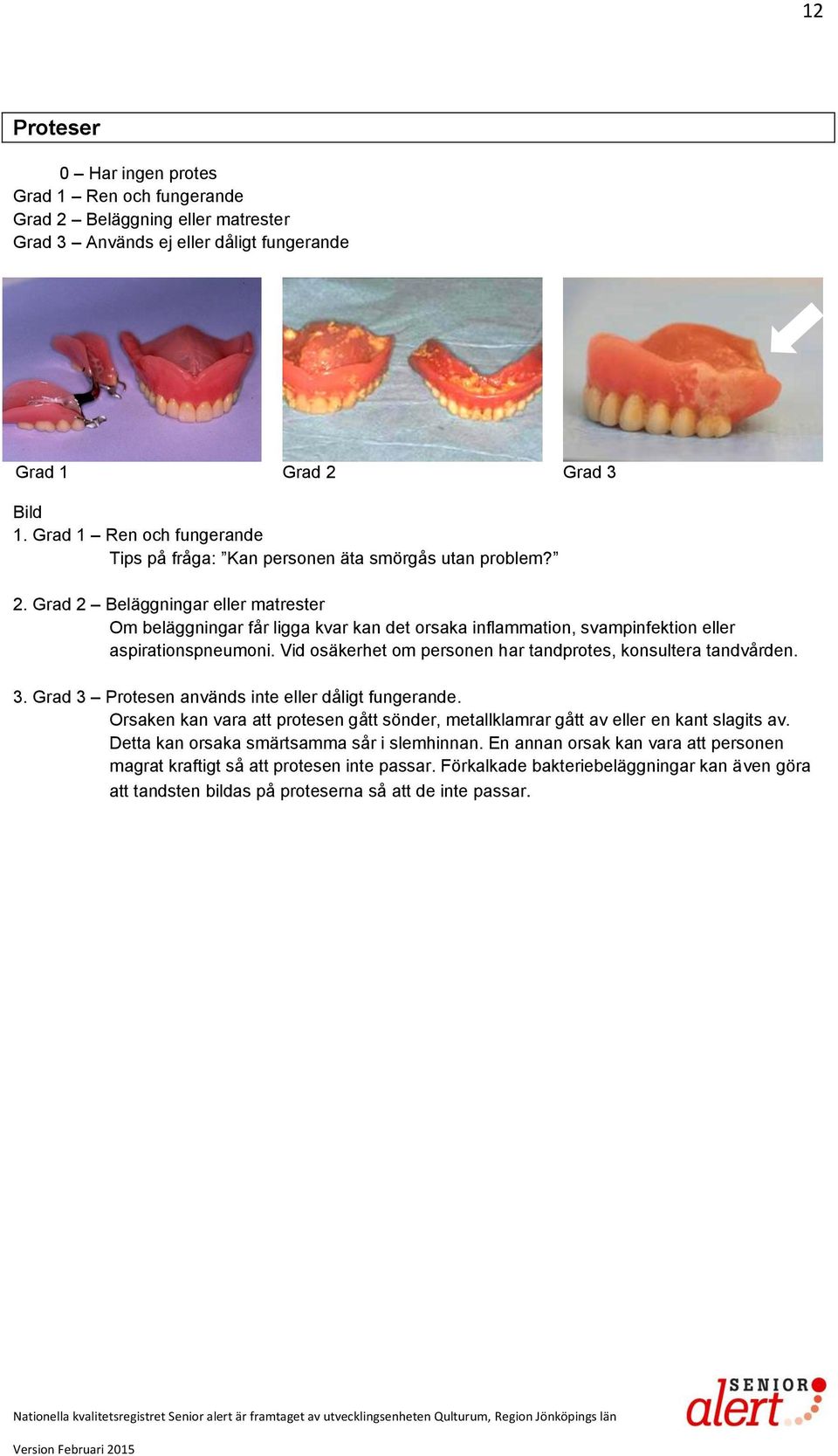 Grad 2 Beläggningar eller matrester Om beläggningar får ligga kvar kan det orsaka inflammation, svampinfektion eller aspirationspneumoni.