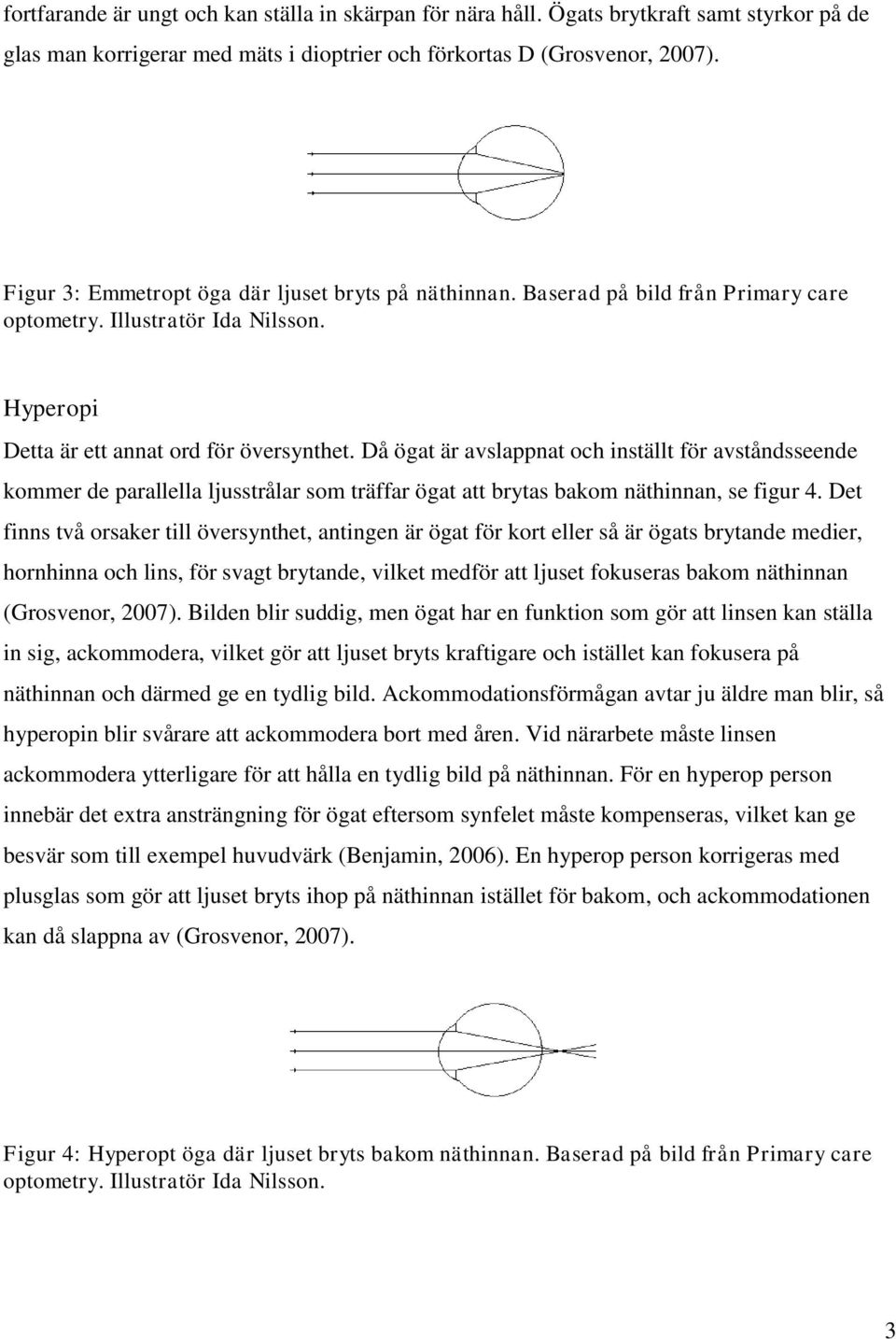 Då ögat är avslappnat och inställt för avståndsseende kommer de parallella ljusstrålar som träffar ögat att brytas bakom näthinnan, se figur 4.