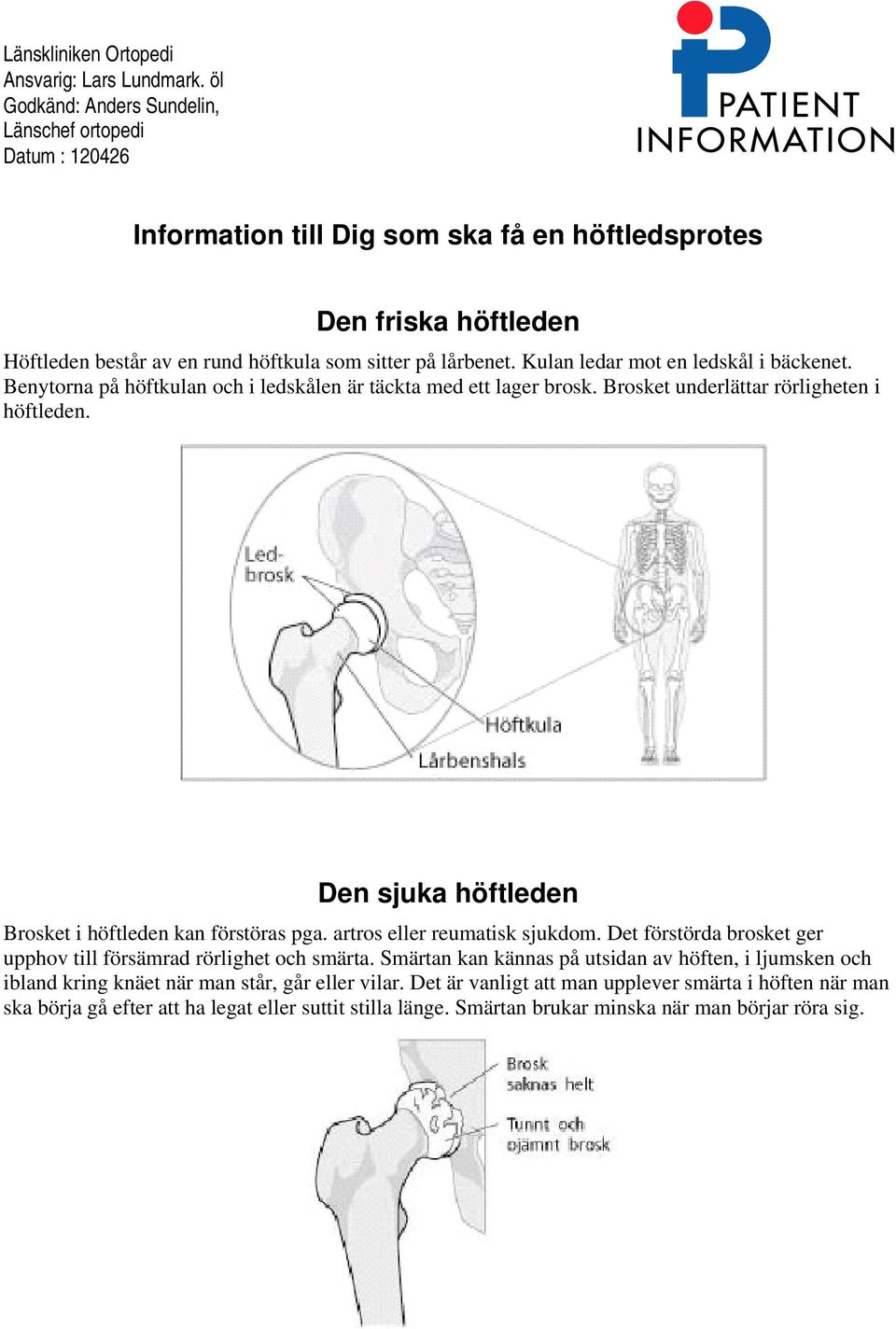 Kulan ledar mot en ledskål i bäckenet. Benytorna på höftkulan och i ledskålen är täckta med ett lager brosk. Brosket underlättar rörligheten i höftleden.
