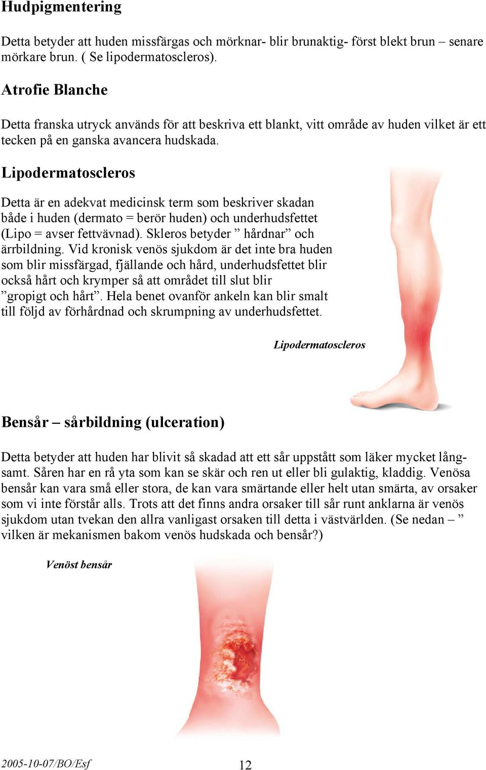 Lipodermatoscleros Detta är en adekvat medicinsk term som beskriver skadan både i huden (dermato = berör huden) och underhudsfettet (Lipo = avser fettvävnad). Skleros betyder hårdnar och ärrbildning.