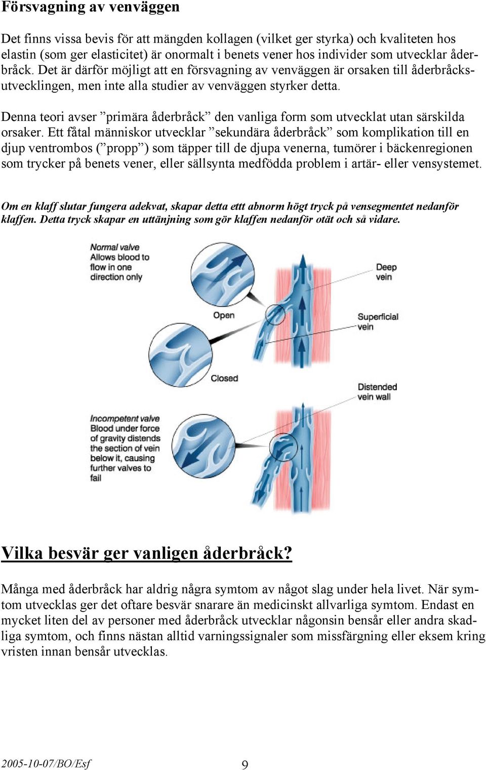 Denna teori avser primära åderbråck den vanliga form som utvecklat utan särskilda orsaker.