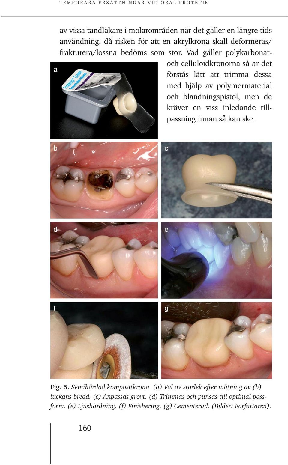 Vad gäller polykarbonatoch celluloidkronorna så är det a förstås lätt att trimma dessa med hjälp av polymermaterial och blandningspistol, men de kräver