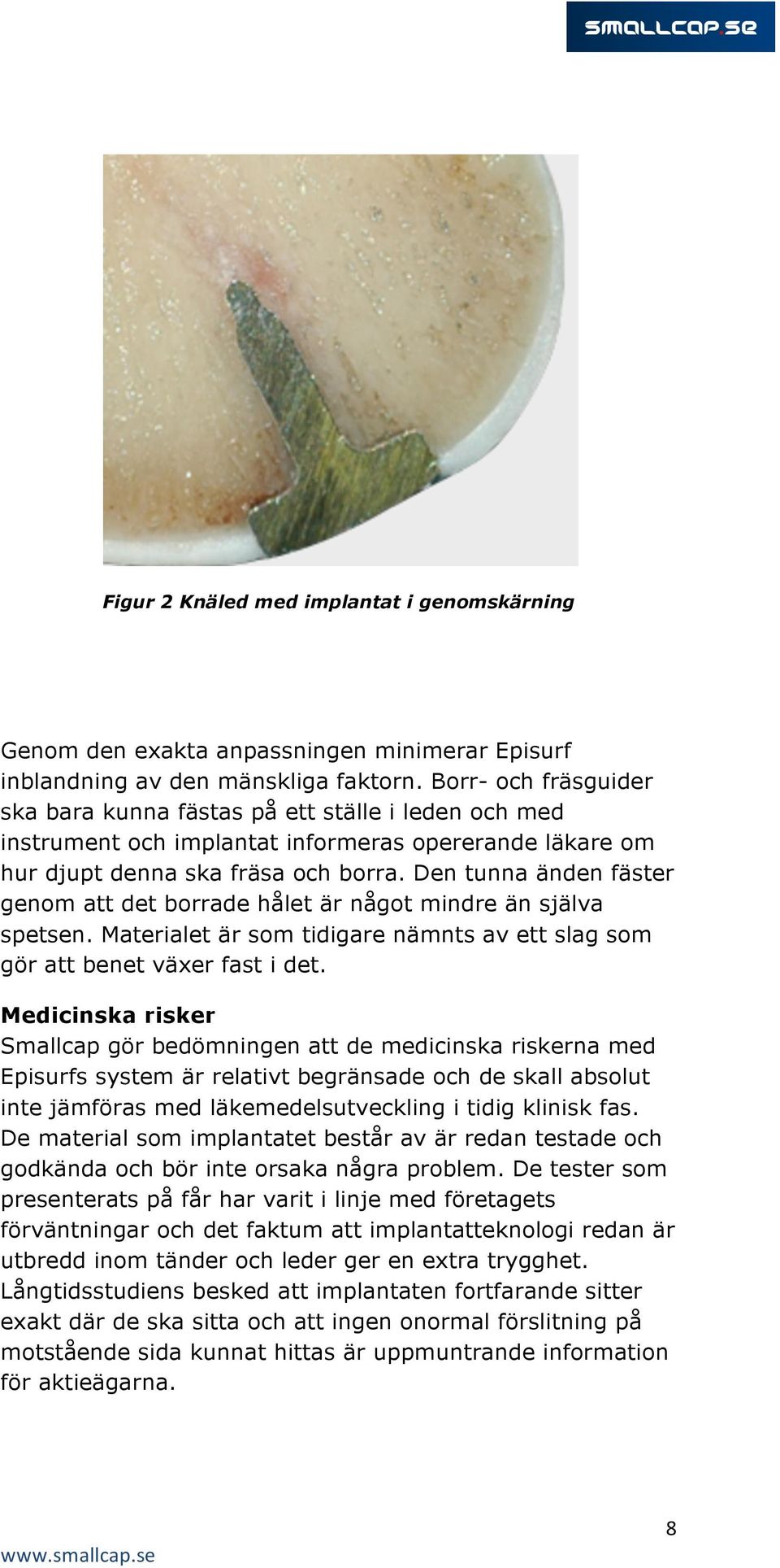 Den tunna änden fäster genom att det borrade hålet är något mindre än själva spetsen. Materialet är som tidigare nämnts av ett slag som gör att benet växer fast i det.